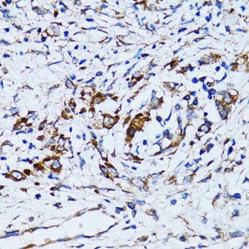 Polyclonal Rabbit anti-Human RARS Antibody (IHC, IF, WB)