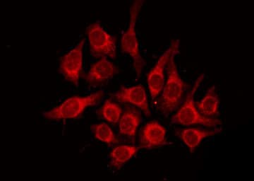 Neuropeptide Y / NPY Antibody