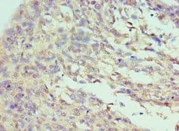 NF90 / ILF3 Antibody (aa785-894)