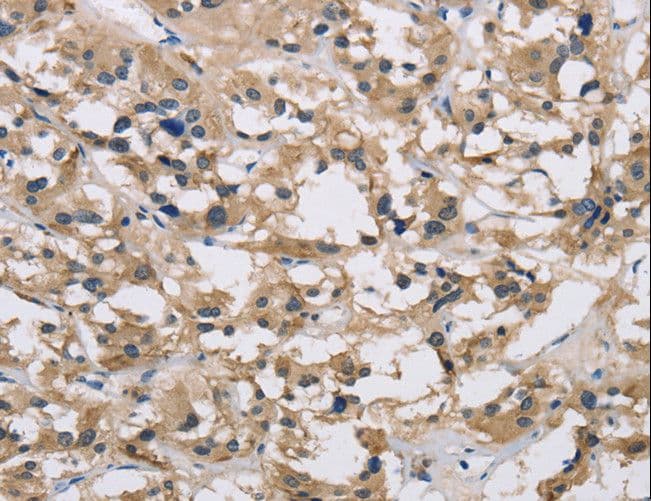 Polyclonal Rabbit anti-Human IMPDH1 Antibody (IHC, WB)