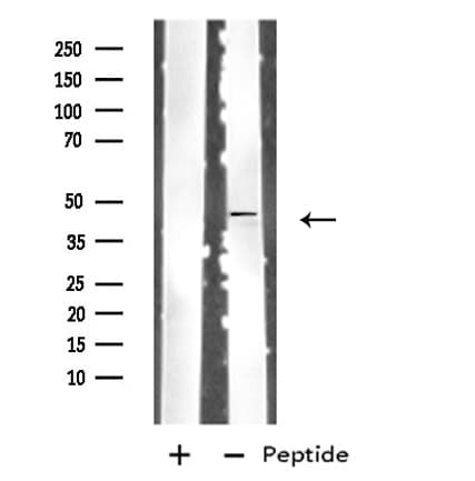 Polyclonal Rabbit anti-Human CSF2RA / CD116 Antibody (IF, WB)
