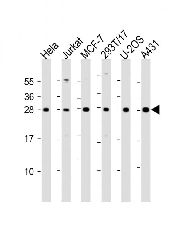 RPL14 / Ribosomal Protein L14 Antibody (aa117-147)