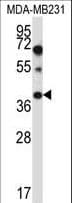 IHC-plus™ HACD1 / PTPLA Antibody (aa37-66)