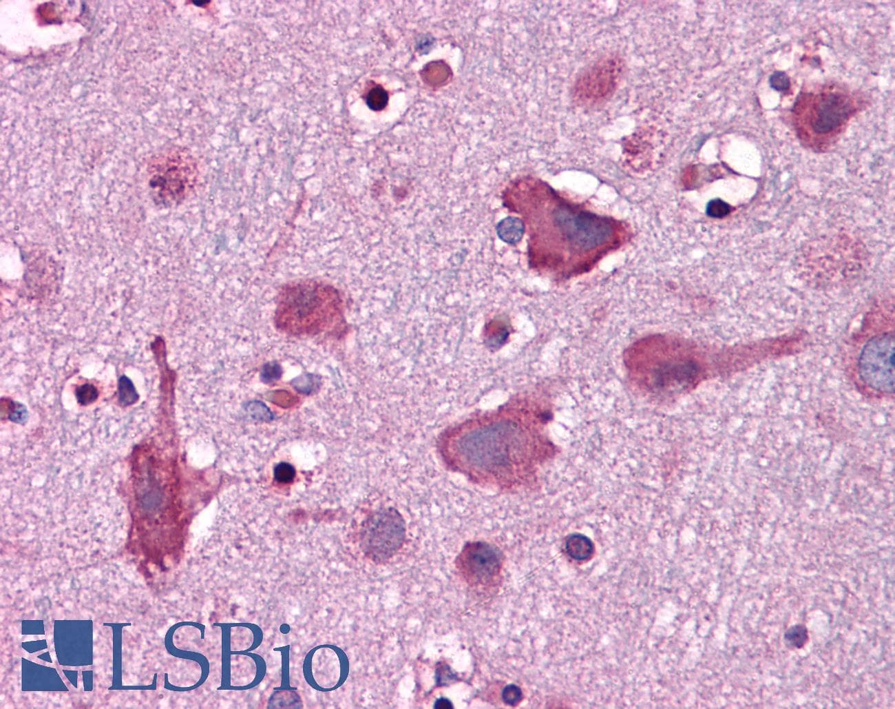 IHC-plus™ LRFN3 Antibody