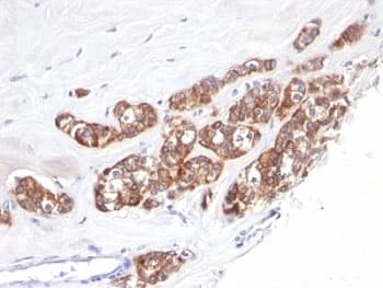 Cytokeratin 1+8 Antibody (clone SPM510)
