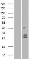 TMEM129 Protein (Over-Expression Lysate Myc-DDK (Flag))