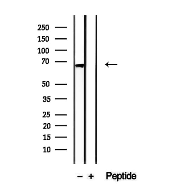 Polyclonal Rabbit anti-Human LGTN / EIF2D Antibody (IHC, IF, WB)