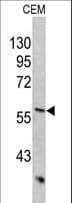 KRT10 / CK10 / Cytokeratin 10 Antibody (aa318-346)