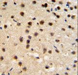 FKBP10 / FKBP65 Antibody (aa57-87)