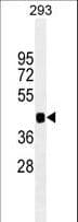 PAX6 Antibody