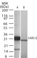 SARS-CoV Envelope Antibody (aa59-70)