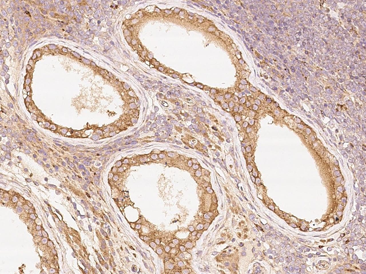 PRKACA Antibody (Preservative Free)