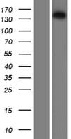IRS Protein (Over-Expression Lysate Myc-DDK (Flag))