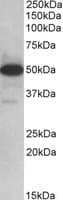 IHC-plus™ Polyclonal Goat anti-Human TXNDC5 / ERP46 Antibody (aa281-295, IHC, WB)