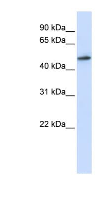 Polyclonal Rabbit anti-Human RNMT / HCM Antibody (aa108-157, WB)