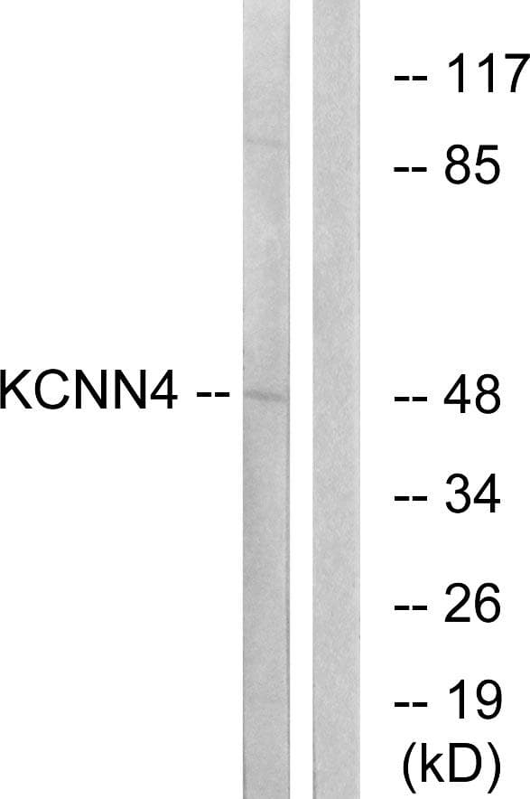 KCNN4 / KCa3.1 Antibody