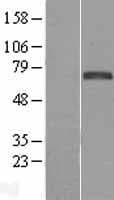 FOXC1 Protein (Over-Expression Lysate Myc-DDK (Flag))