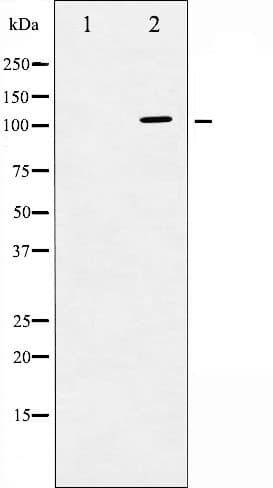 Polyclonal Rabbit anti-Human PLA2G4A Antibody (IHC, IF, WB)