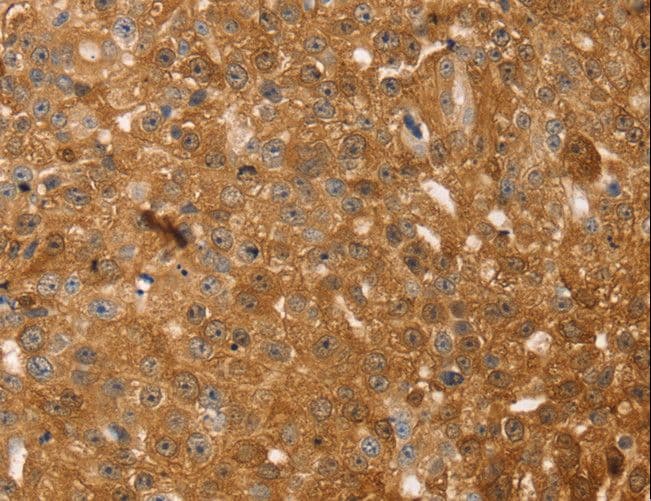 TMSB10 / Thymosin Beta 10 Antibody