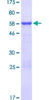 Human HNRNPH3 / hnRNP H3 Protein (Recombinant GST)