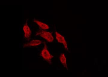 Polyclonal Rabbit anti-Human BCL2 / Bcl-2 Antibody (IHC, IF, WB)