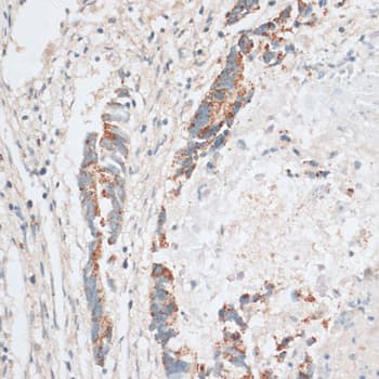 Polyclonal Rabbit anti-Human HMG-CoA Reductase / HMGCR Antibody (IHC, WB)