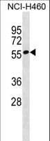ZNF302 Antibody (aa52-79)