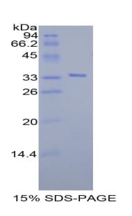 Mouse CXCL1 / GRO Alpha Protein (Recombinant His-GST)