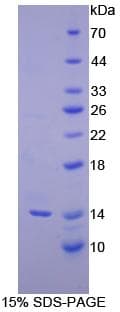 Human INHBC Protein (Recombinant His)