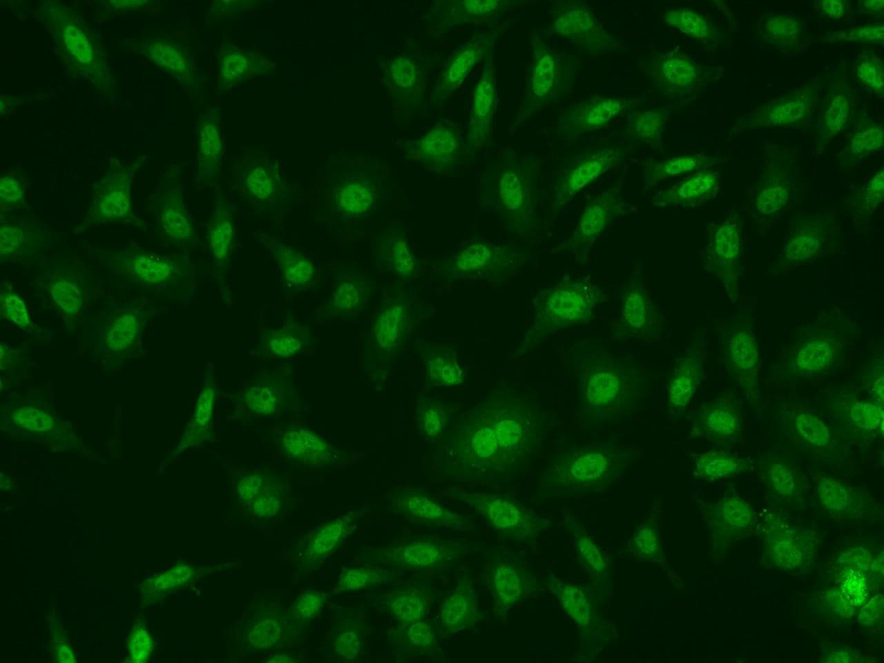 OPG / Osteoprotegerin Antibody