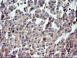NFKBIA / IKB Alpha / IKBA Antibody (clone OTI2F5)
