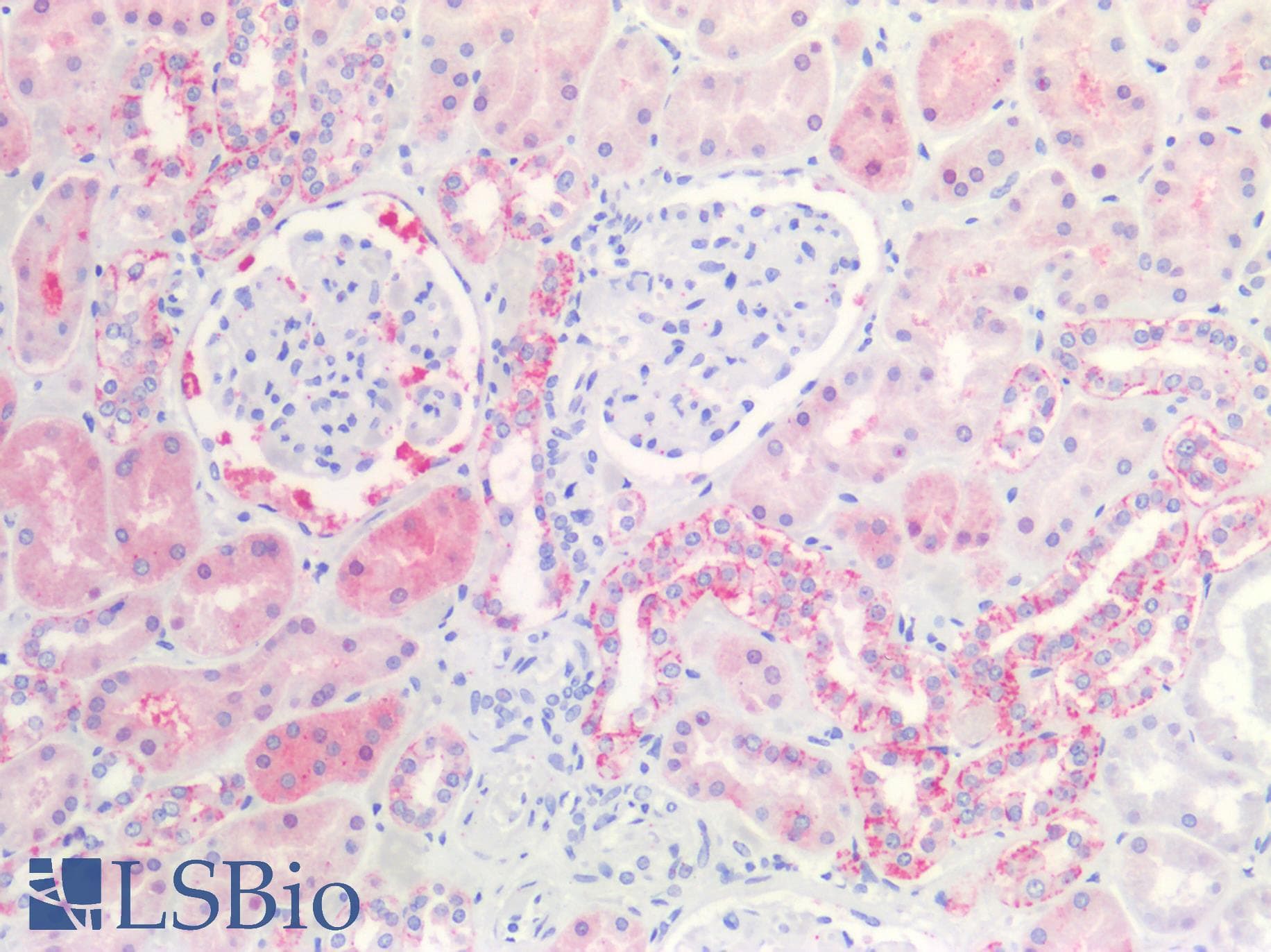 PathPlus™ CLDN4 / Claudin 4 Antibody (C-Terminus, clone 3E2C1)
