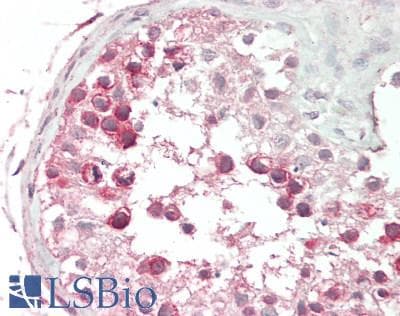 IHC-plus™ KIF11 / EG5 Antibody