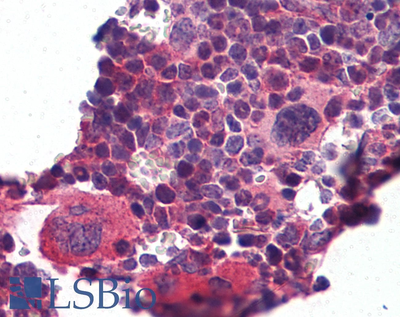 KLF2 Antibody (N-Terminus)