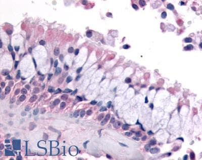 PathPlus™ OR6K3 Antibody (N-Terminus)