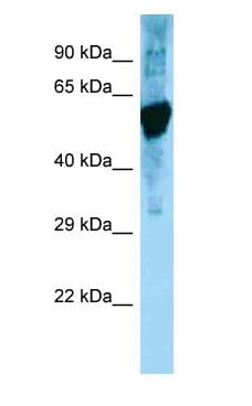 Polyclonal Rabbit anti-Rat HSPD1 / HSP60 Antibody (aa378-427, WB)