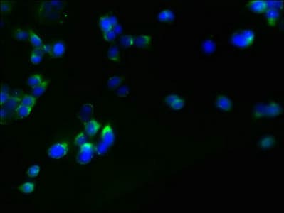 Polyclonal Rabbit anti-Human RHBDL2 / RRP2 Antibody (WB)