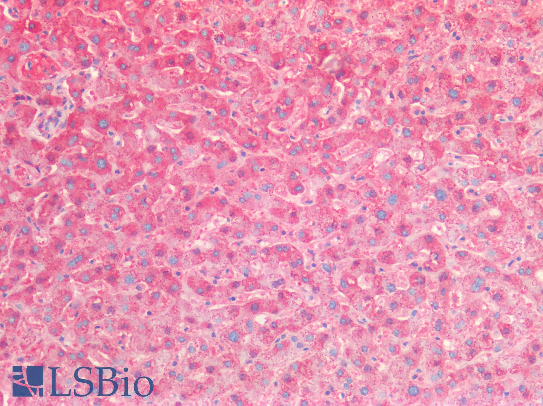 IHC-plus™ Polyclonal Rabbit anti-Human HSPD1 / HSP60 Antibody (IHC, WB)