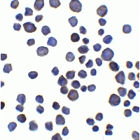Chondroadherin / CHAD Antibody