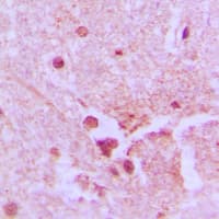 XRCC5 / Ku80 Antibody (Internal)