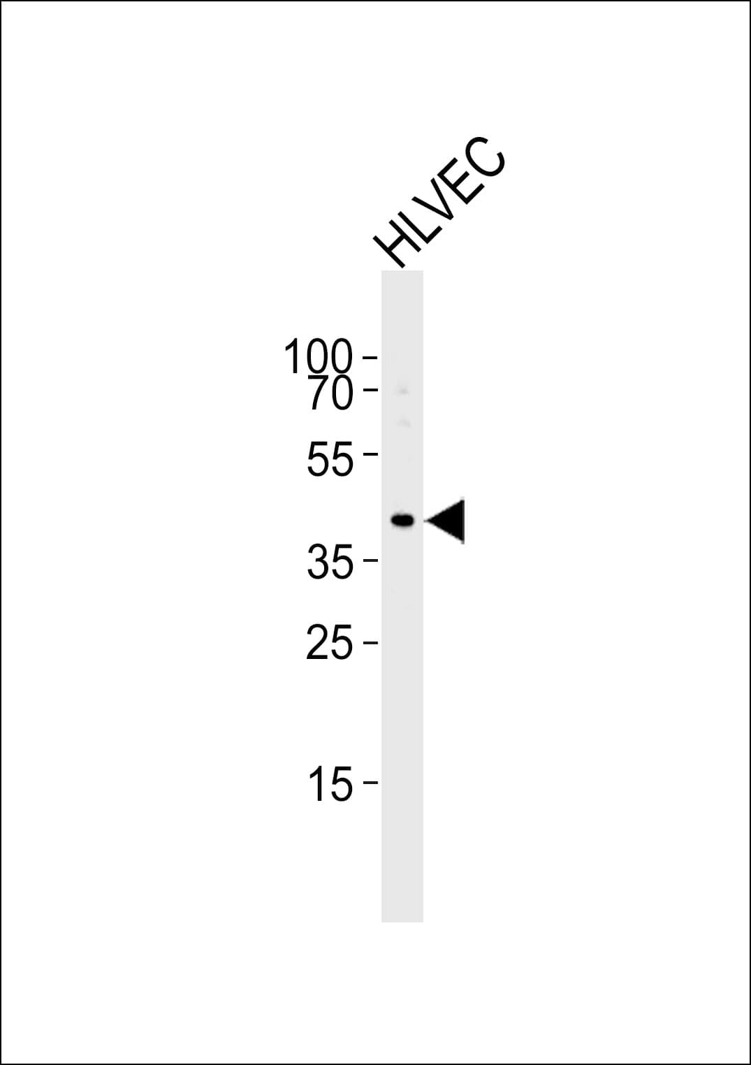 IHC-plus™ TBX1 Antibody (aa327-356)