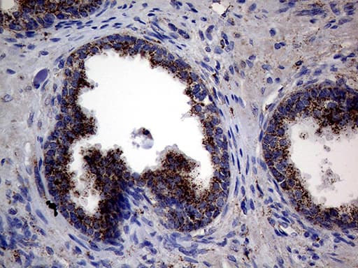 Monoclonal Mouse anti-Human CTSL / Cathepsin L Antibody (clone OTI2H2, IHC, WB)