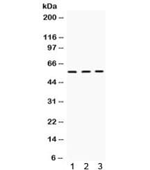 Polyclonal Rabbit anti-Human XIAP Antibody (WB)
