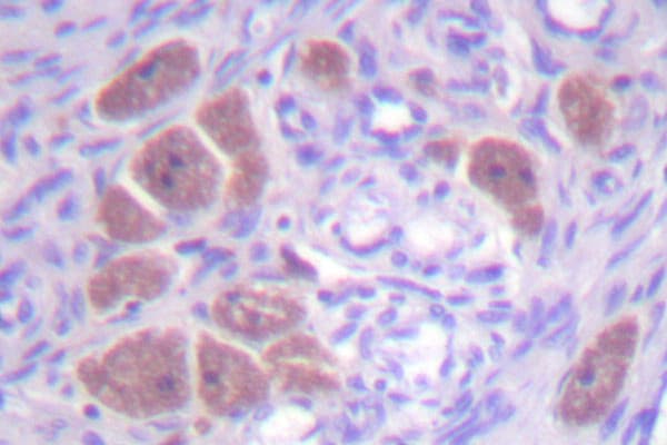 P40PHOX / NCF4 Antibody (Arg149)