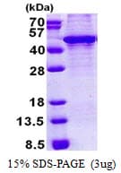 Human KLF3 Protein (Recombinant His)