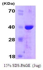 Human PPIE / Cyclophilin E Protein (Recombinant His)