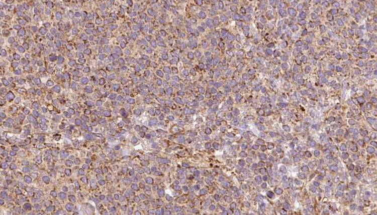 ARL8B Antibody