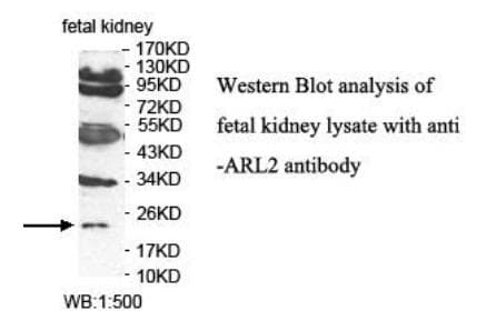 Polyclonal Rabbit anti-Human ARL2 Antibody (aa2-184, WB)
