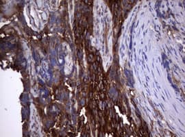 CD30 Antibody (clone OTI16H5)