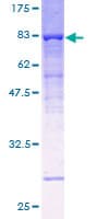 Human ATP6V1B1 Protein (Recombinant GST)